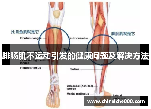 腓肠肌不运动引发的健康问题及解决方法